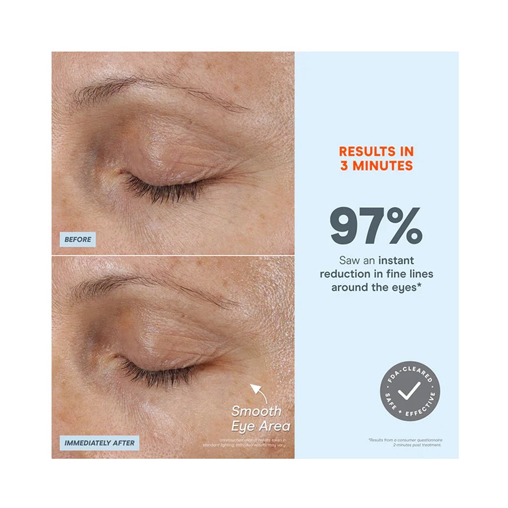 FIX MicroWand - NuFace - Devices - Aida Bicaj
