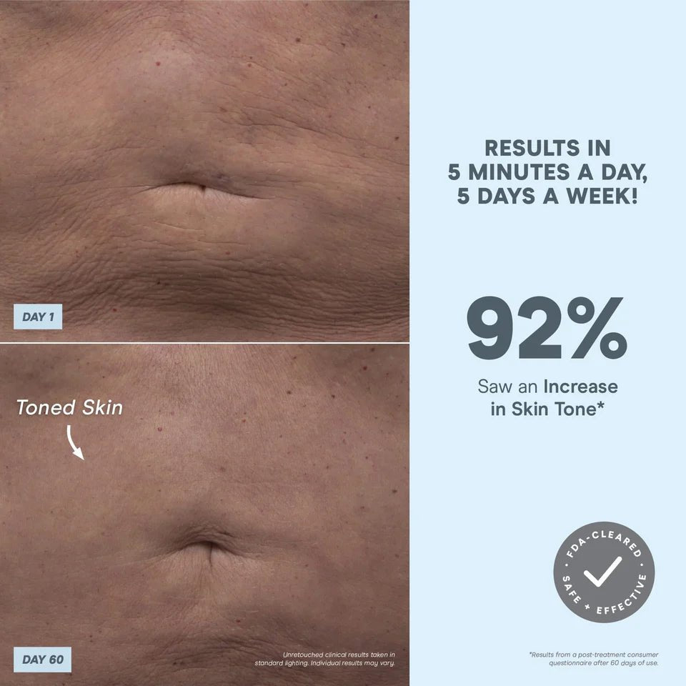 NuBody Skin Toning Device Kit - NuFace - Accessories - Aida Bicaj