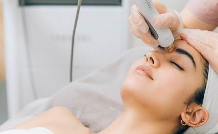 CYNOSURE TEMPSURE RADIOFREQUENCY TREATMENT